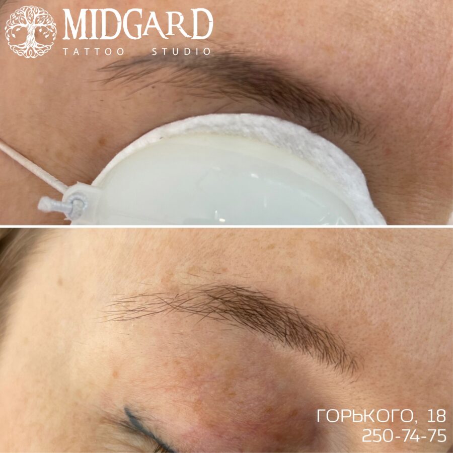 Удаление татуажа в Красноярске для обновления имиджа